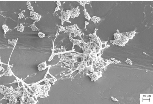 Strutture vegetative e riproduttive di Purpureocillium lilacinum che crescono sul polietilene osservate al SEM