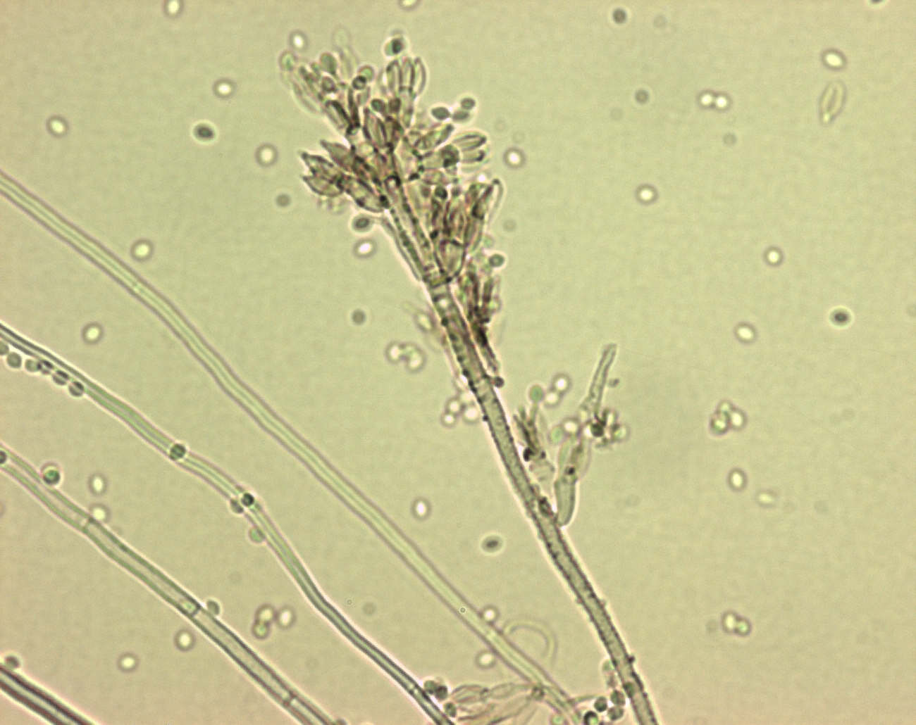 purpureocillium liacinum
